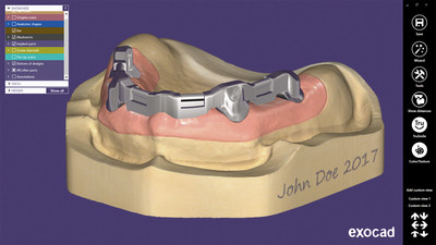 HR - EXOCAD – Gred na implantatih